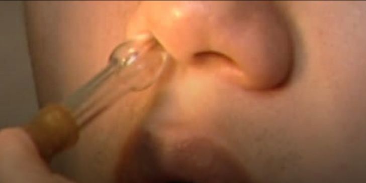 Man's stuffy nose